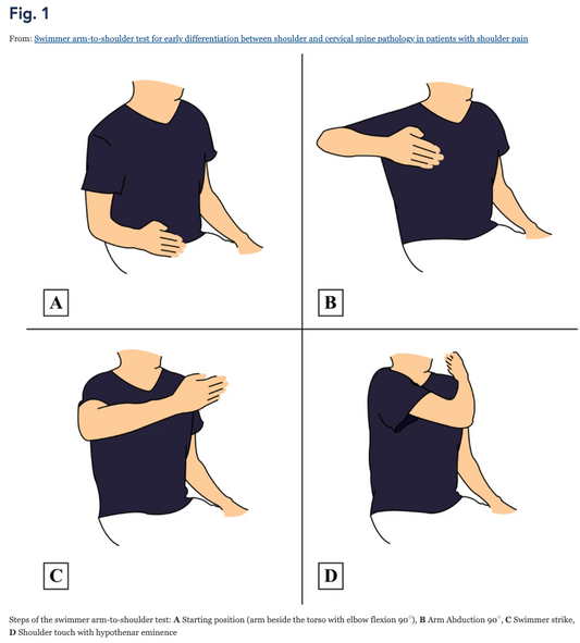 The Swimmer arm-to-shoulder test for early differentiation between shoulder and cervical spine pathology in patients with shoulder pain